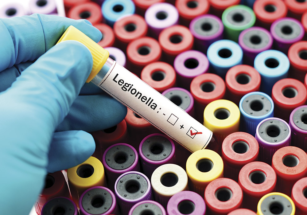 legionella
