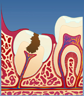 hull i visdomstenner